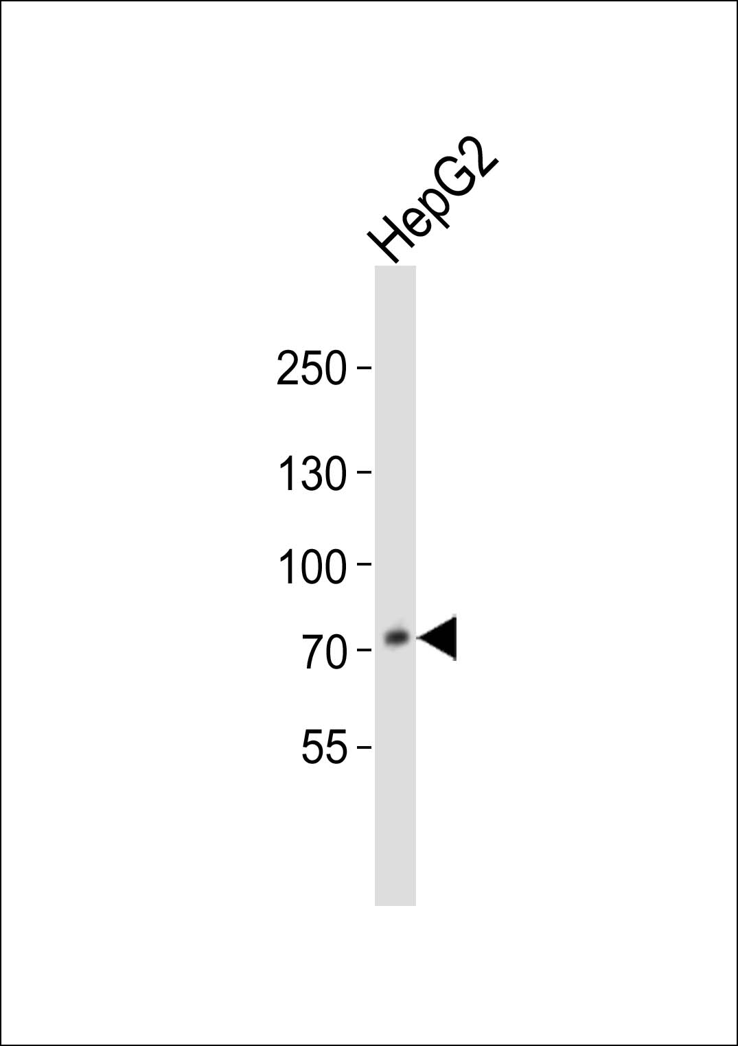 WB - PCSK9 Antibody (C-term) AP7333b